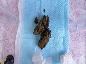 極太便のエロい女　サンプル画像04